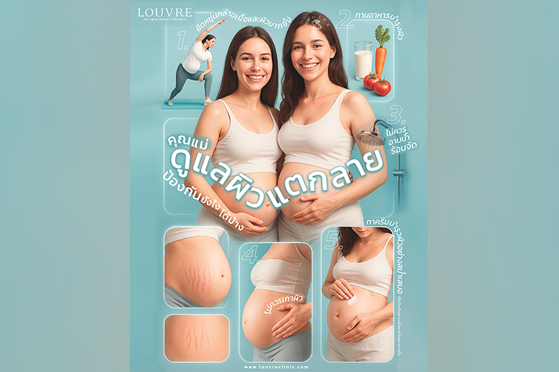  ผิวแตกลาย...คุณแม่ป้องกันได้!