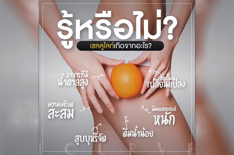  เซลลูไลท์ (Cellulite)